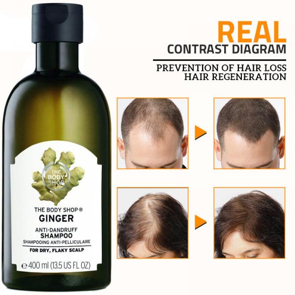 Load image into Gallery viewer, The Body Shop Ginger Scalp Care Shampoo
