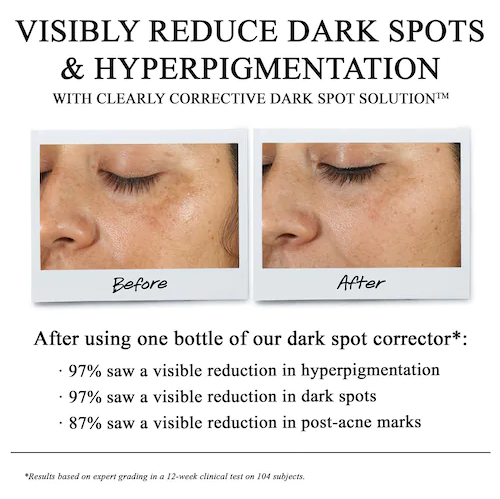 Load image into Gallery viewer, Kiehl&#39;s Since 1851 Clearly Corrective Dark Spot Correcting Serum
